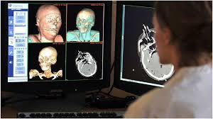 解析年轻女性逝者遗体：探究死因与生前健康状况_解剖刚死亡年轻女尸